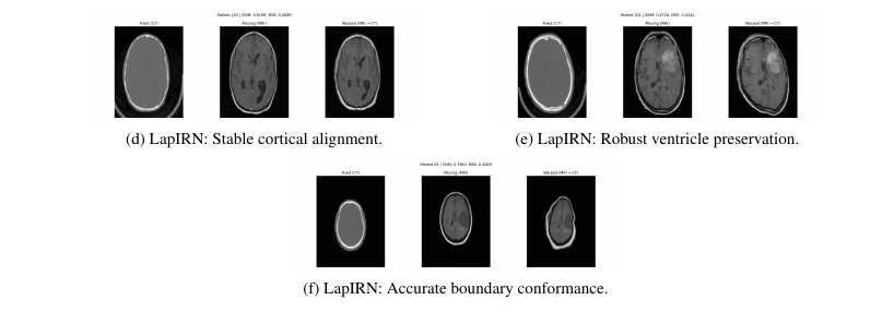 Qualitative comparison figure