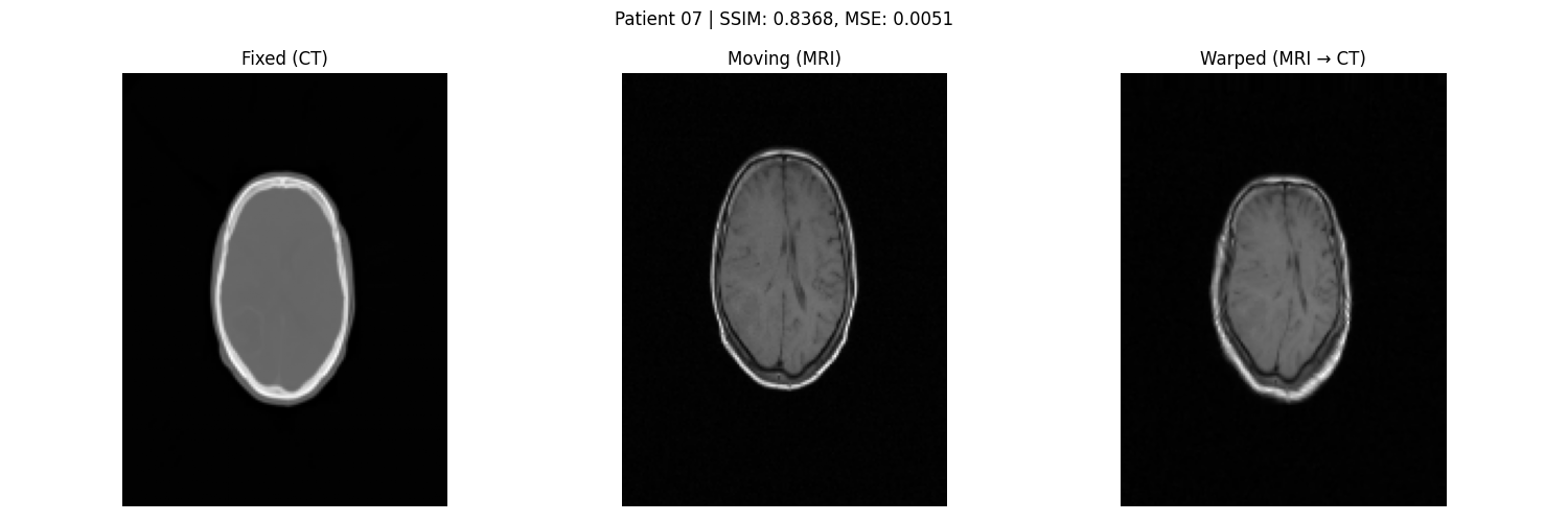 Comparative Study of Classical and Deep Learning-Based Methods for Multi-Modal Brain Image Registration