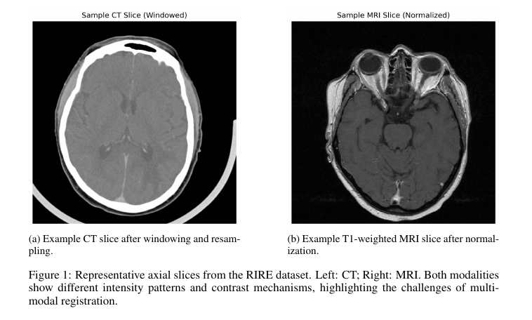 Example CT and MRI slices