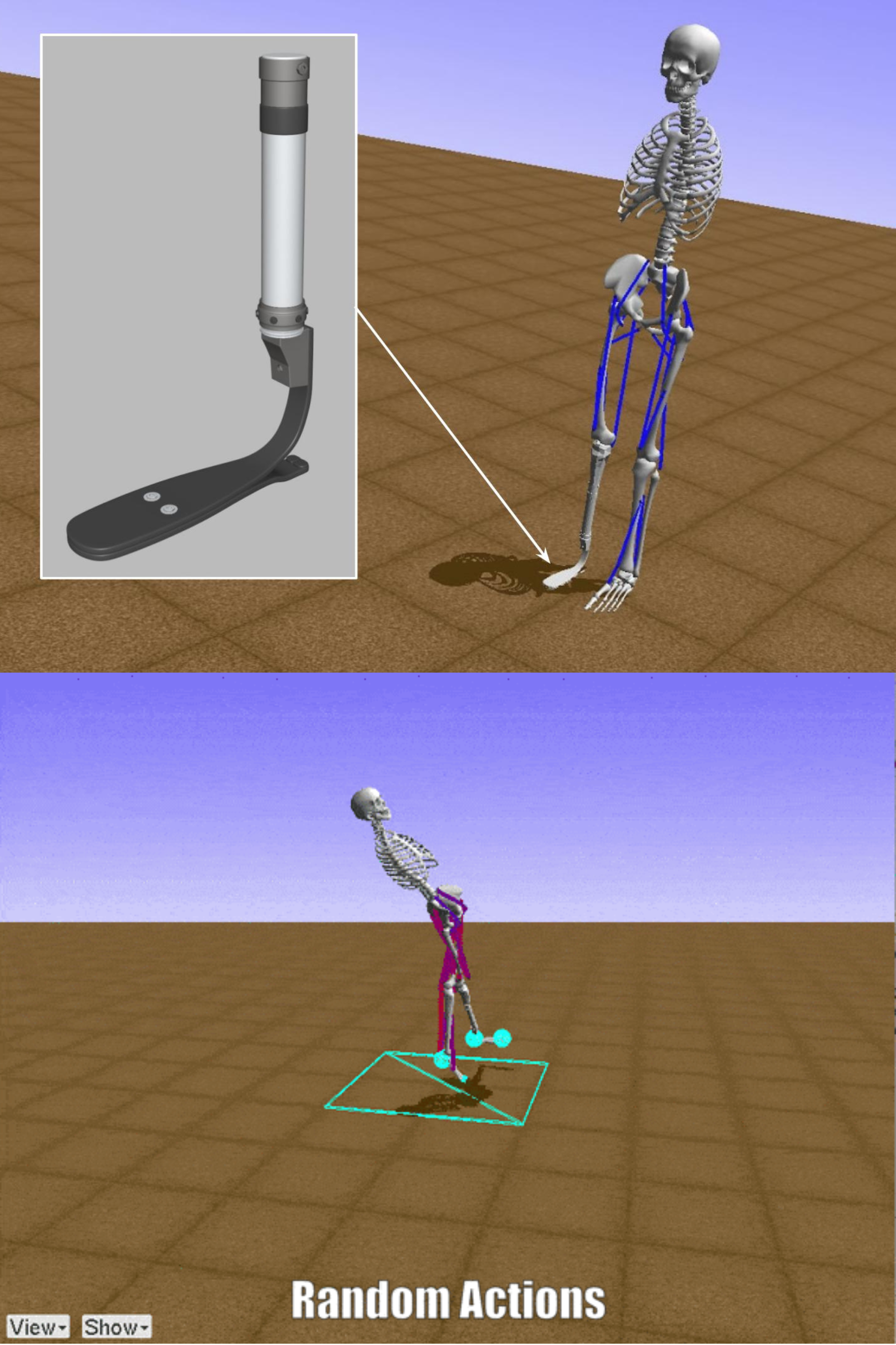 Transfer Learning for Prosthetics Using Imitation Learning